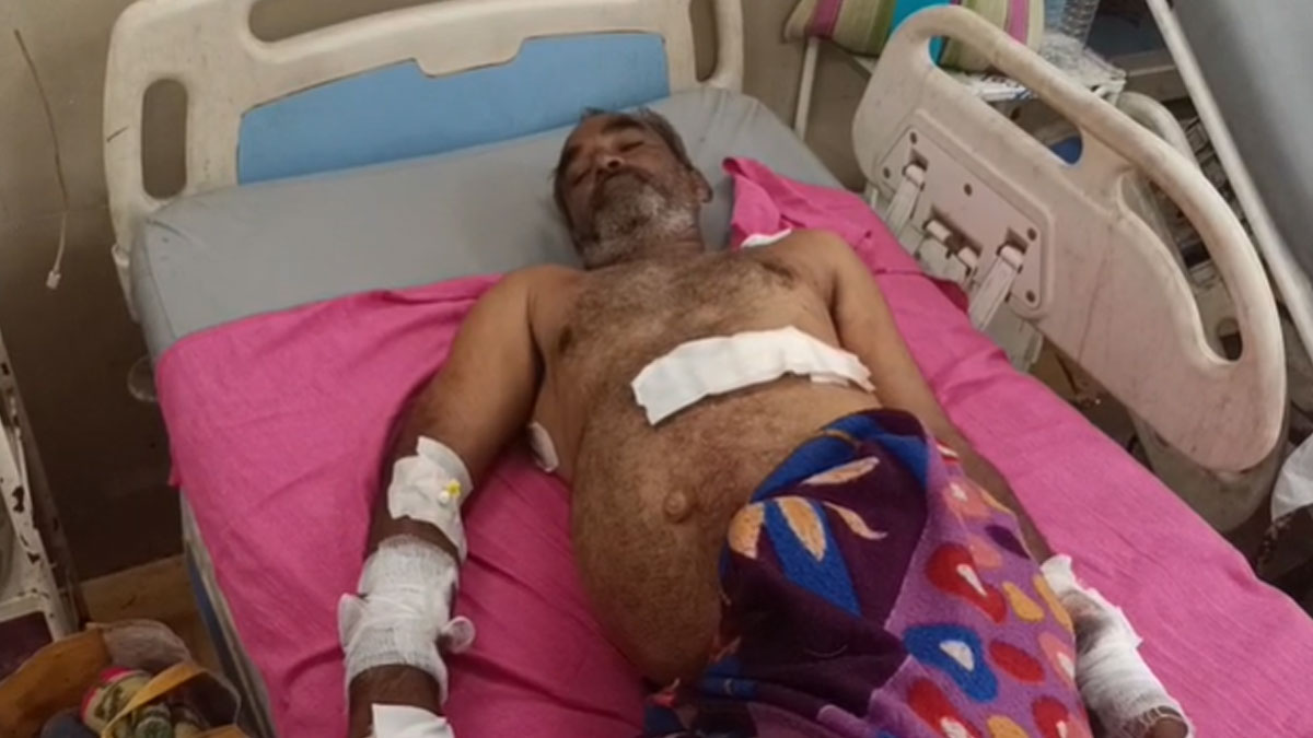 Buldhana: ﻿करवंड में भालू ने दो लोगों पर किया हमला; एक गंभीर रूप से घायल, दूसरे को अकोला किया गया रेफर