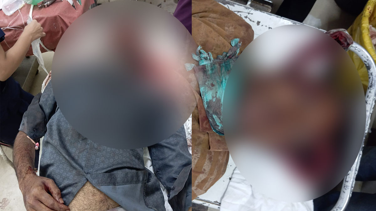 Nagpur: खापरखेड़ा में  सोते हुए दो लोगों पर हमला, ईंट-पत्थरों से सिर कुचला; हालत गंभीर