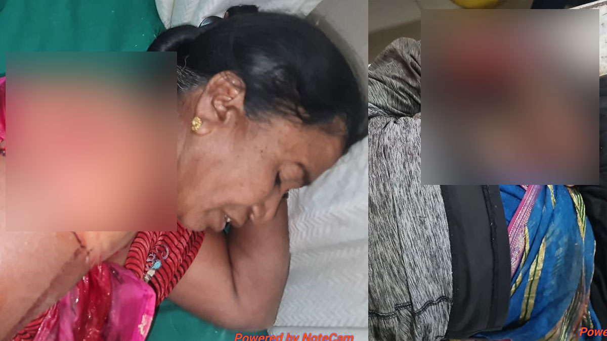 Chandrapur: जंगली सुअर के हमले में दो महिलाएं गंभीर रूप से घायल भद्रावती तहसील की घटना; चंद्रपुर रेफर